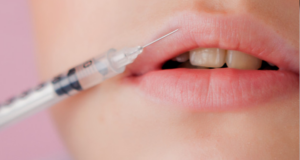 Rty jak hollywoodské hvězdy? Co je důležité vědět ohledně botoxu? Bolí to nebo je to bezbolestné?
