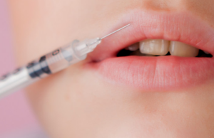 Rty jak hollywoodské hvězdy? Co je důležité vědět ohledně botoxu? Bolí to nebo je to bezbolestné?